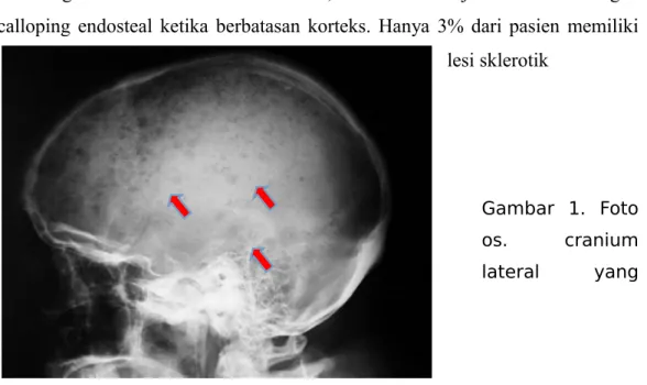 Gambar   1.   Foto os. cranium lateral yang