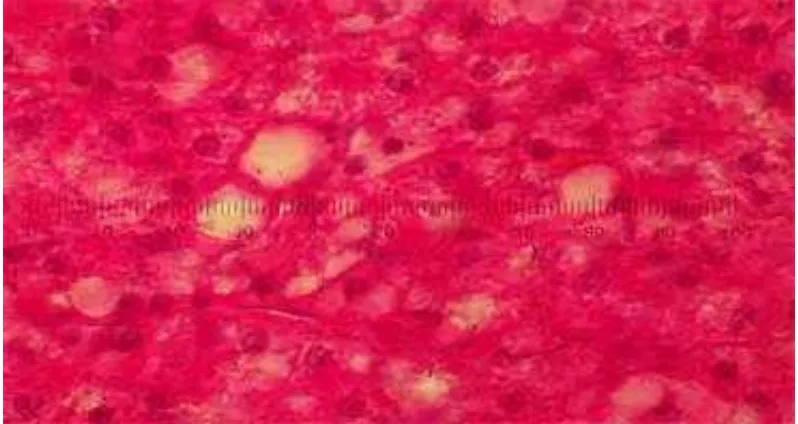 Gambar 3. Histologi hati ikan lele (Clarias sp) yang diberi perlakuan B(8) (pembesaran 1000 x)