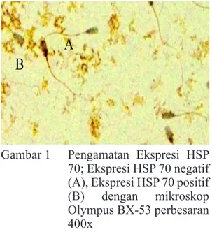 Gambar 1   Pengamatan  Ekspresi  HSP  70; Ekspresi HSP 70 negatif  (A), Ekspresi HSP 70 positif  (B) dengan mikroskop  Olympus BX-53 perbesaran  400x