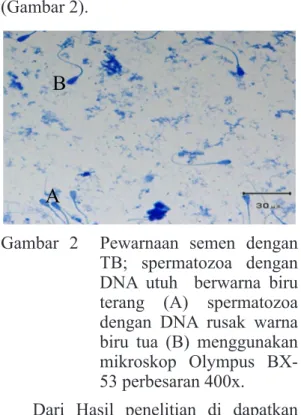 Gambar 2  Pewarnaan semen dengan  TB; spermatozoa dengan  DNA utuh  berwarna biru  terang (A) spermatozoa  dengan DNA rusak warna  biru tua (B) menggunakan  mikroskop  Olympus   BX-53 perbesaran 400x.