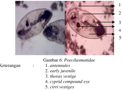 Gambar  5 memperlihatkan  bahwa  Vorticella  sp.  yang  ditemukan  berbentuk  seperti  lonceng,  berwarna  kekuning-kuningan,  memiliki  contracted  cell,  macronucleus,  adoral  membrane  dan  tangkai  yang  panjang