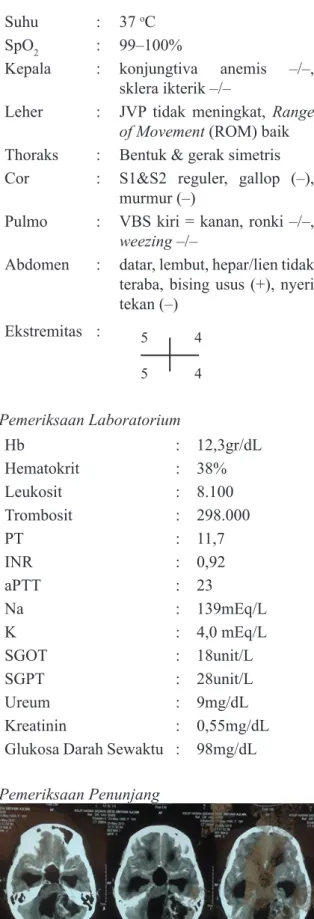 Gambar 1. CT-scan Kepala