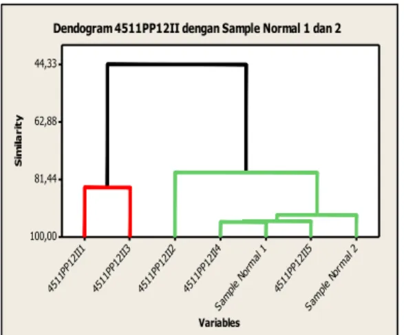 Gambar  4. Hasil analisa Panjang Gelombang Dengan  Spektrum Raman pada jaringan normal dan Sampel 