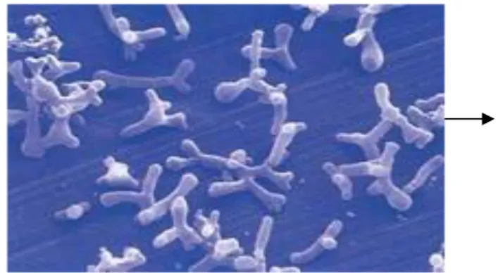 Gambar 1. Bentuk Sel Bifidobacterium  (Anonim a , 2009) 