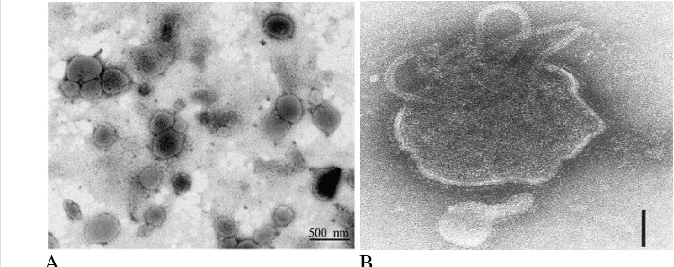 Gambar 1 Struktur virus Newcastle Disease secara mikroskopis.  