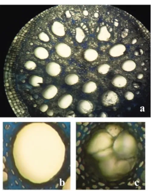 Gambar 3. Penampang melintang akar tanaman pisang yang diimbas dengan asam fusarat 4,66 ppm dengan ketahanan moderat: penampang melintang akar (a); xilem sehat (b); xilem tilosis (c)
