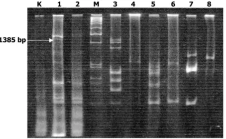 Gambar 1. Fragmen DNA hasil amplifikasi RT-PCR menggunakan primer CI 5560 R dan 4176 F