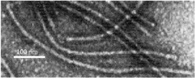 Gambar 2. Partikel nukleoprotein dari isolat lemah SMV. Bar dalam micrograph 100 nm 