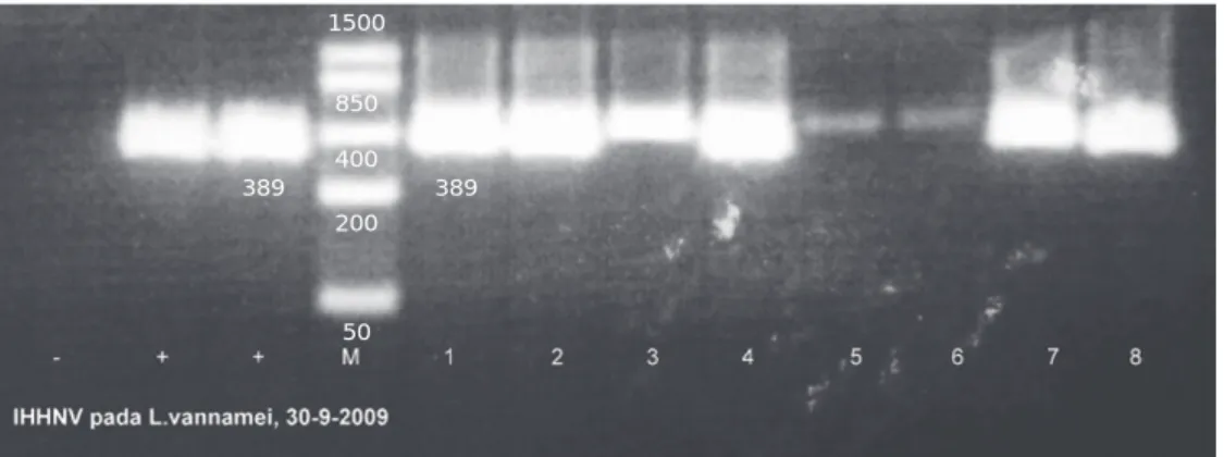 Gambar 4. Profil amplifikasi PCR sampel udang L. vannamei yang terinfeksi IHHNV pada target berat molekul 389 bp
