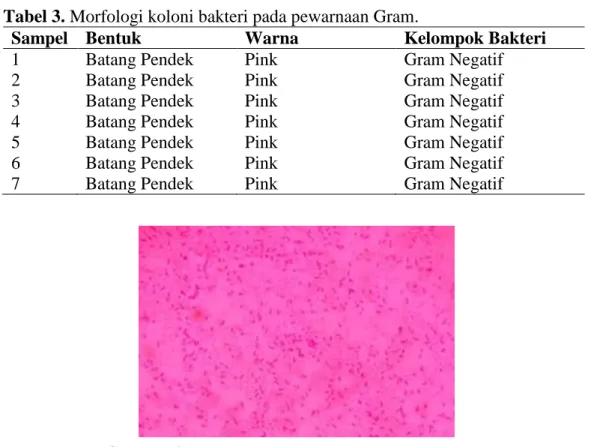 Gambar 2.  Koloni Coliform dari sampel 3 pada media Briliance E.coli/Coliform   Selective  Medium
