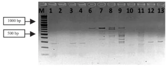 Gambar 4. Elektroforegram Hasil PCR Gen NRPS