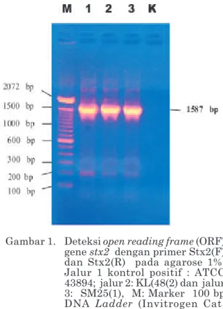 Gambar 1. Deteksi open reading frame (ORF) gene stx2  dengan primer Stx2(F) dan Stx2(R)  pada agarose 1%.