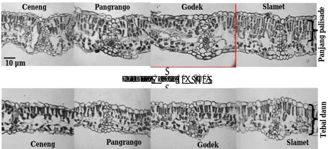 Gambar 1.  Ketebalan daun dan panjang palisade (µm) empat genotipe kedelai dalam intensitas cahaya 100% (I100) dan  50% (I50) 