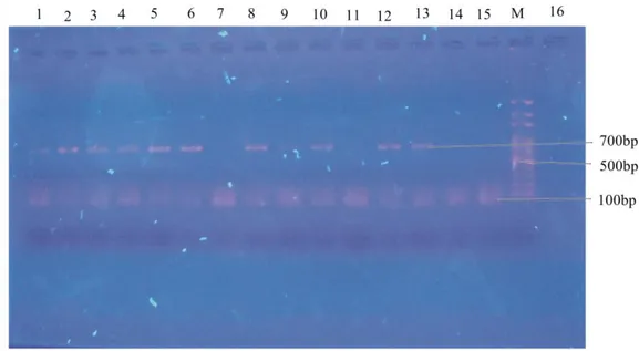 Gambar 5.   Hasil Elektroforesis produk PCR dengan gel  agarose 1%  yang telah  diwarnai  dengan  etidium  bromide  dengan  marker  100  pasang  basa  DNA ladder (invitrogen) 