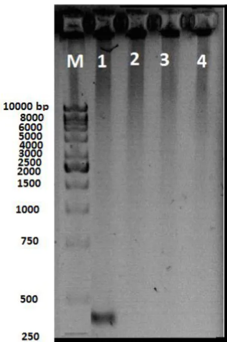 Gambar 7. Hasil amplifikasi gen PSY dengan  menggunakan primer 2. 