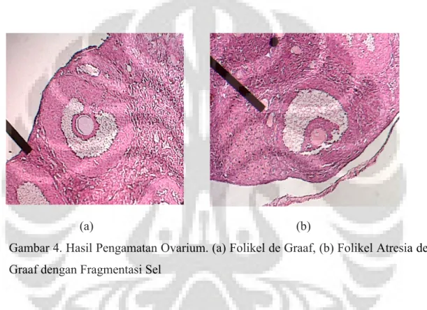 Gambar 4. Hasil Pengamatan Ovarium. (a) Folikel de Graaf, (b) Folikel Atresia de  Graaf dengan Fragmentasi Sel 