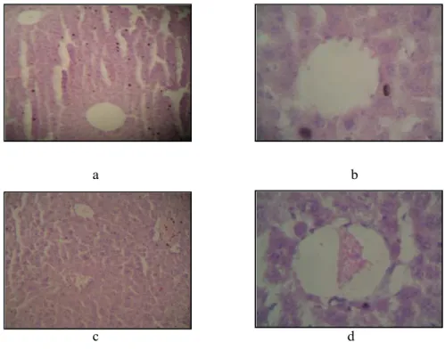 Gambar 3. Gambaran mikroskopik hati mencit kelompok air rebusan daun sirih 20% 
