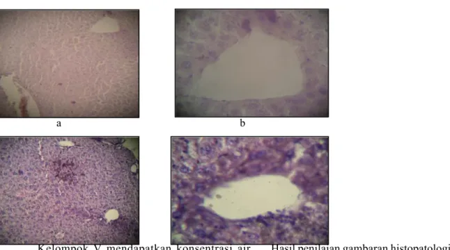 Gambar 4. Gambaran mikroskopik hati mencit kelompok air rebusan daun sirih 40% 