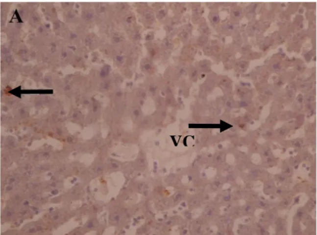 Gambar 1. Ekspresi Tumor Necrosis Faktor Alpha (TNF-α) pada organ hati (400x) 