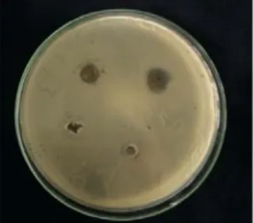 Gambar 4. Hasil uji aktivitas antibakteri gel hand sanitizer ekstrak etanol buah asam gelugur IIIIIIK+K+K‐8%2%4%1%
