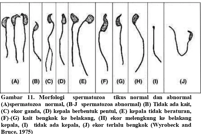 Gambar 11. Morfologi  spermatozoa  tikus normal dan abnormal  