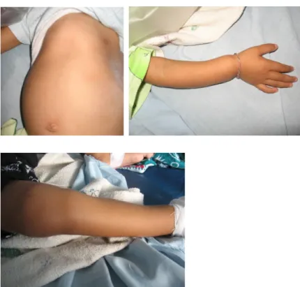 Gambar 1. Foto abdomen, tangan dan kaki pasien.