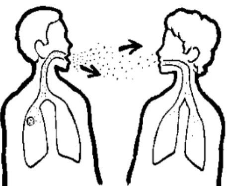 Gambar 2. Tuberkulosis menyebar lewat udara