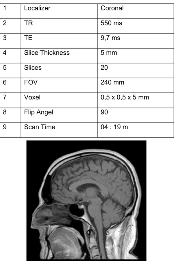 Tabel 1. Parameter sekuens T1 Weighted Spin Echo Sagital