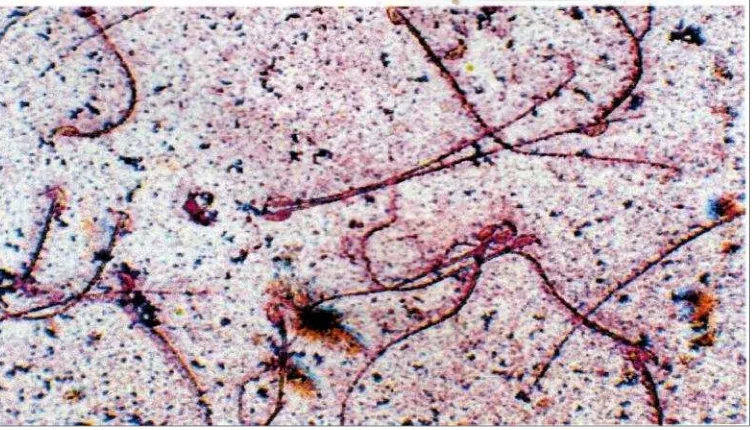 Gambar 5. Spermatozoa mencit, dapat dilihat kepala yang bengkok seperti kaitdan bagian ekor yang sangat panjang (perbesaran 400x) (BFS,2012).