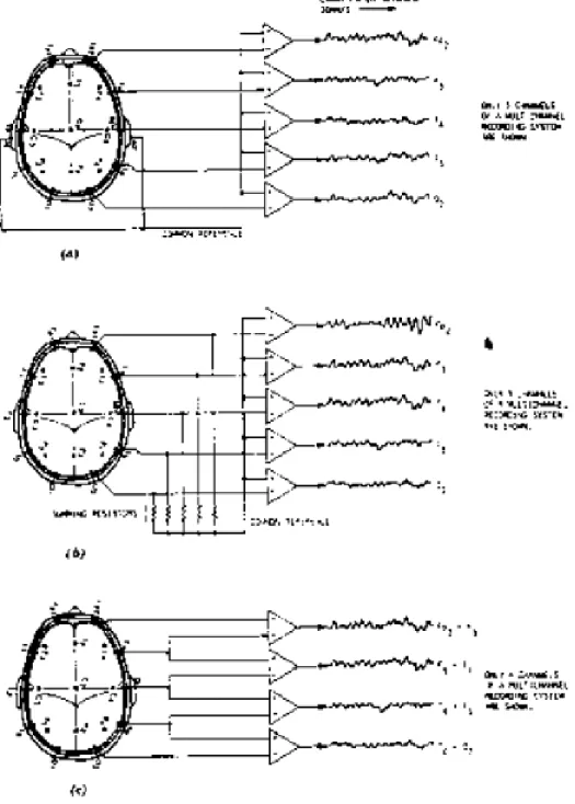 Figure 10. EEG recording modes: (a) uniploar, (b) average, (c) bipolar.