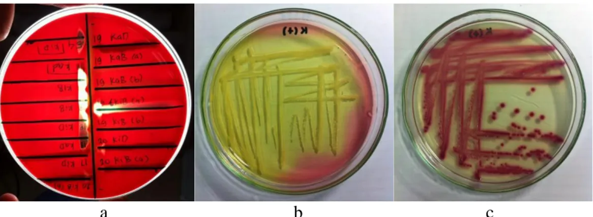 Gambar  1    (a)  hasil  positif  uji  CAMP  (b)  kontrol  positif  S.  aureus  pada  media  Mannitol  Salt  Agar  (c)  kontrol  positif  E