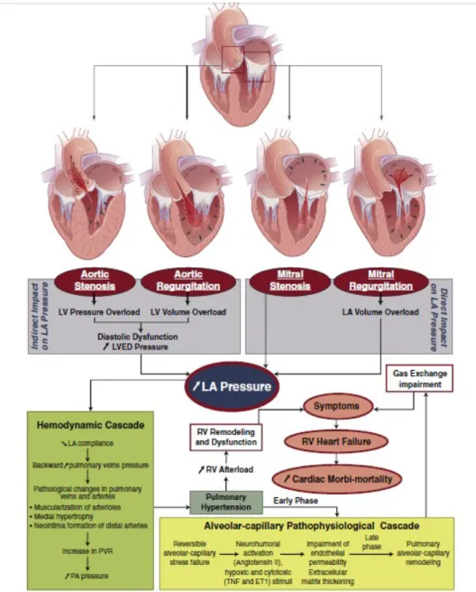 Gambar 2. Mekanisme terjadinya hipertensi pulmonal pada penyakit jantung bawaan (Magne et al, 2015).