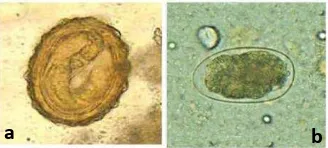 Gambar 4: (a) Telur (pembesaran 40 x 10) A. lumbricoides fertil  dan (b) infertil (Prianto, J., dkk., 2006) 