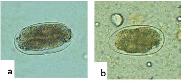 Gambar 10. (a) Ancylostoma duodenale (b) Necator americanus (pembesaran 20 x 10)  (Prianto, J., dkk., 2006) 