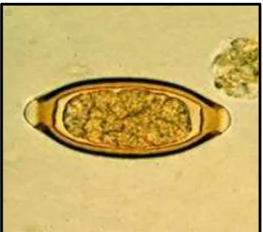 Gambar 10. Siklus Hidup Cacing Cambuk (Trichuris trichiura) (Anonim, 2008) 