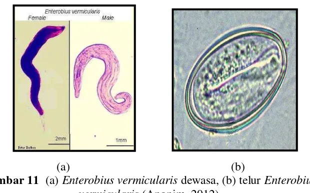 Gambar 11  (a) Enterobius vermicularis dewasa, (b) telur Enterobius 