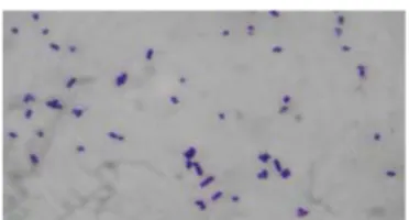 Gambar 4. Bacillus licheniformis  Berdasarkan pengecatan gram  tersebut, mikroba dibagi dalam dua 