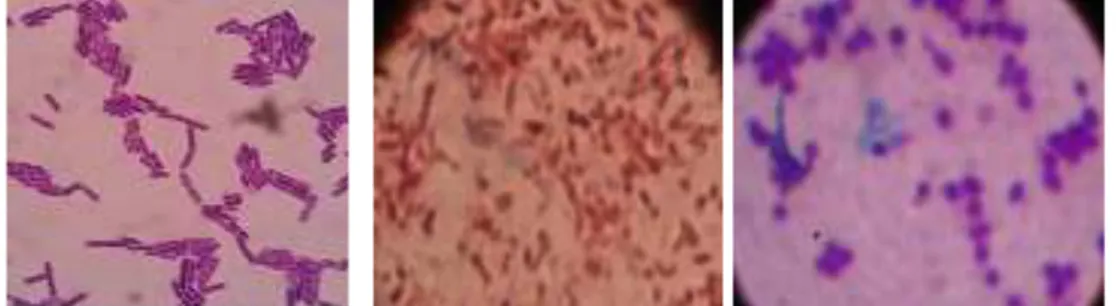 Gambar 2. 4. Bakteri Bacillus, Vibrio dan Staphylococcus saat diamati dengan mikroskop   perbesaran 1000x  