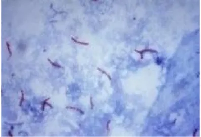 Gambar Mycobacterium Tuberculosis 4 2.3 Patogenesis Tuberkulosis