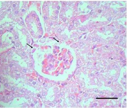 Gambar 10. Edema glomerulus pada ginjal tikus yang dikelilingi oleh tubulus yangmengalami degenerasi hidropik (Suyanti, 2008).