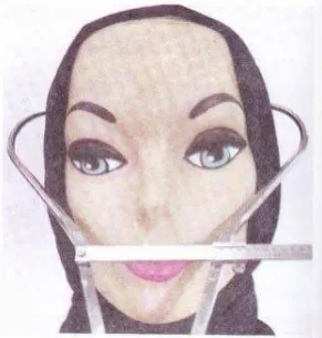 Gambar 6. Lebar Kepala 