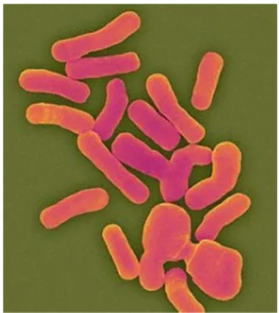 Gambar 1. Koloni Methylobacterium sp. 