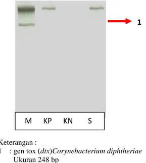 Gambar 1. Hasil Pembacaan Peng- Peng-gandaan Produk DNA  pada Spesi-  men Tersangka dengan Teknik  PCR 