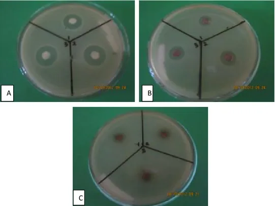 Gambar 2. Hasil uji antibiotik isolat Actinomycetes terhadap bakteri Staphylococcus aureus   Keterangan : 