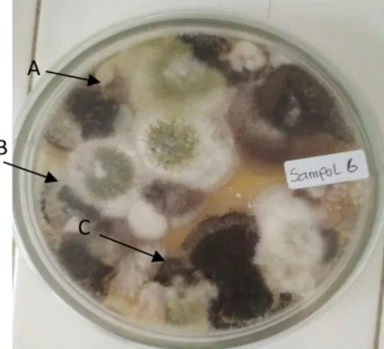 Gambar  1.  Koloni  Aspergillus  sp  yang  tumbuh  pada  media  biakan  Sabouraud’s  Dextrose  (SDA)  Agar  umur  7  hari