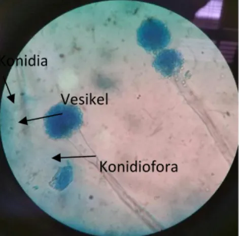 Gambar 2. Mikroskopis Aspergillus sp dengan menggunakan pewarnaan Lactophenol  Cotton Blue (LCB) pembesaran 400x