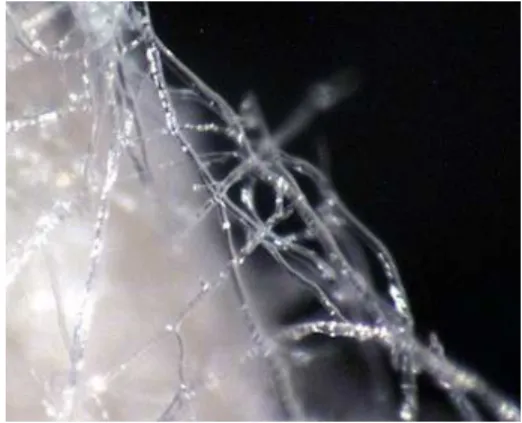 Gambar 5. Foto Mikrograf Miselia Rhizopus oligosporus pada Fase Transisi         Sumber : William Shurtleff (2010) 