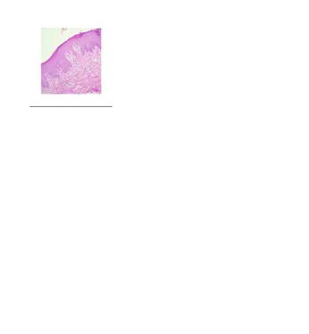 Gambar 1. Gambaran Histopatologis Pitiriasis Rosea