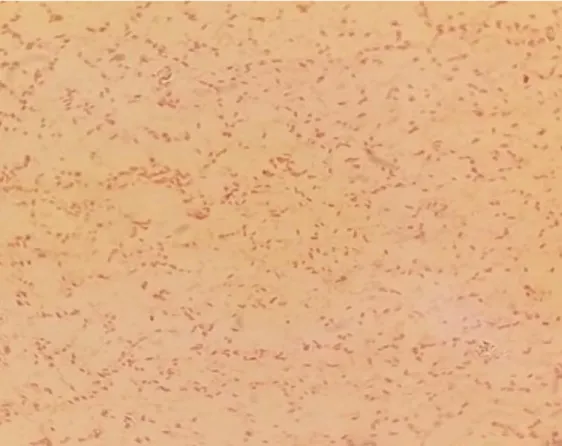 Gambar 4. Bakteri Salmonella sp hasil pewarnaan Gram dibawah mikroskop  10000x                                                                                                                                                                                  
