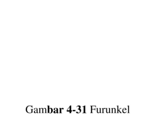 Gambar 4-31 Furunkel